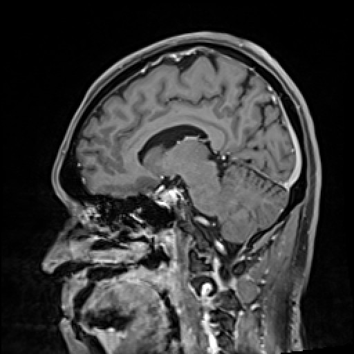 Click on the Serie image to view the images of VILLANUEVA, WILLIAM A.